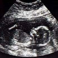 London clinic shares ultrasound images