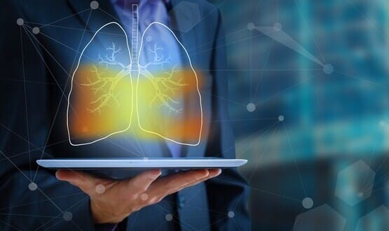 Clinithink and AstraZeneca launch AI project for lung cancer detection